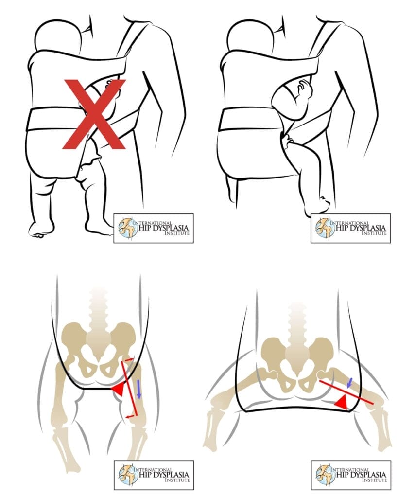 Infant positioning